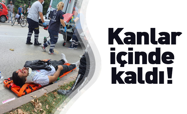 Kanlar içinde kaldı!