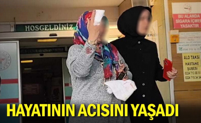 Hayatının acısını yaşadı