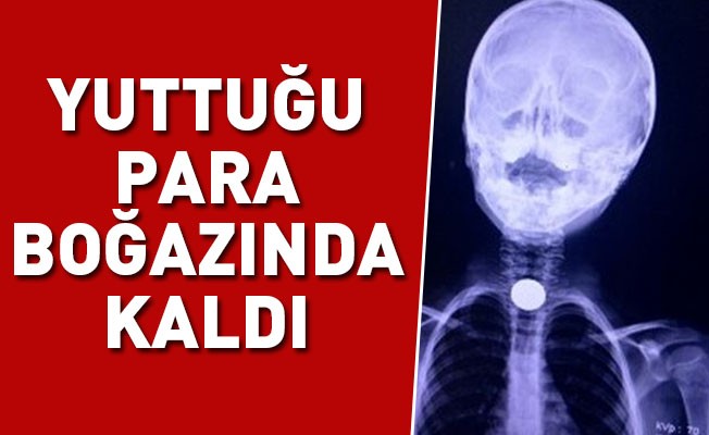 Yuttuğu para boğazında kaldı