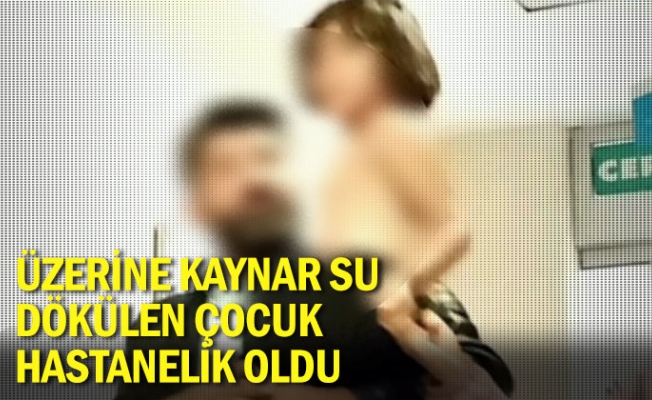 Üzerine kaynar su dökülen çocuk hastanelik oldu