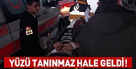 Yüzü tanınmaz hale geldi!