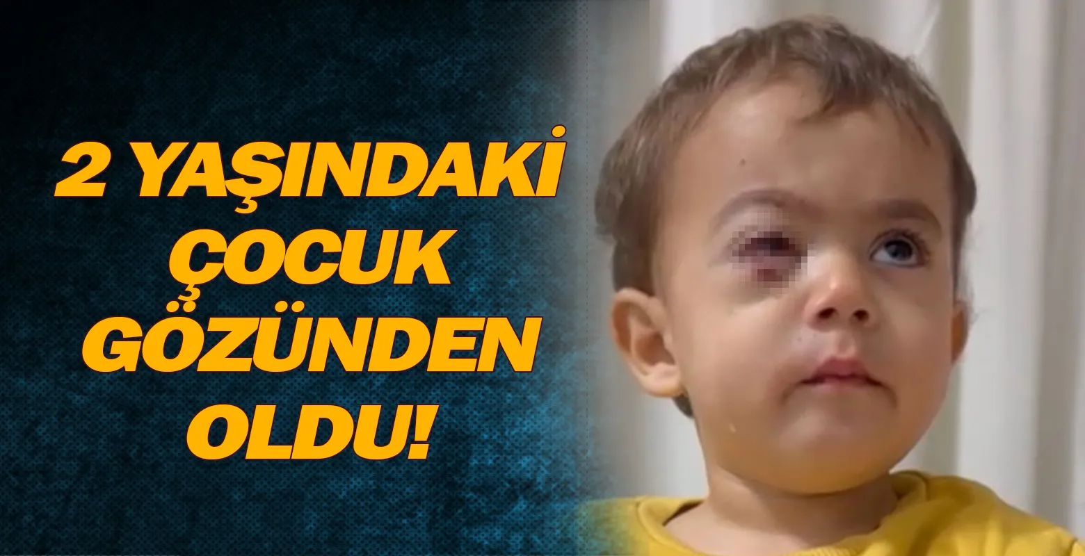 2 yaşındaki çocuk gözünden oldu